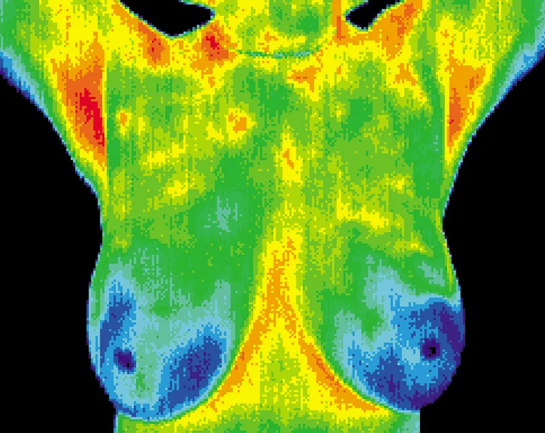 Thermography showing breast heat patterns as a non-invasive screening option in midlife women’s health.